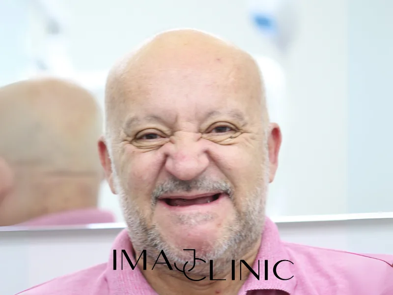 Tedavi öncesi vaka 9