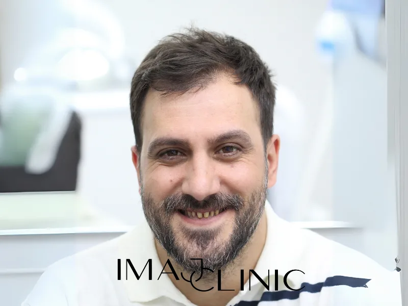Tedavi öncesi vaka 23