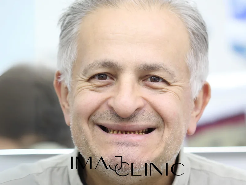 Tedavi öncesi vaka 2