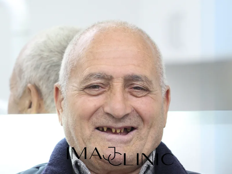 Tedavi öncesi vaka 21