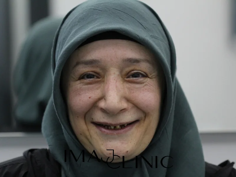 Tedavi öncesi vaka 13