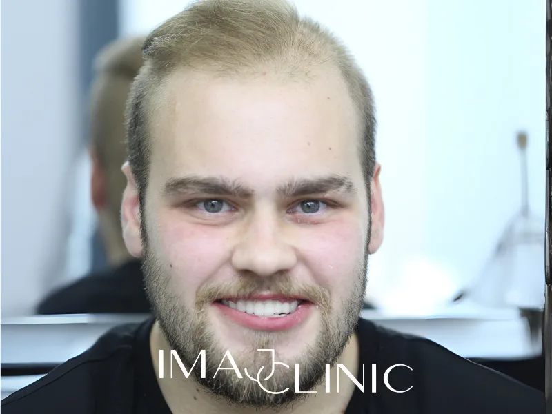 Tedavi sonrası vaka 16