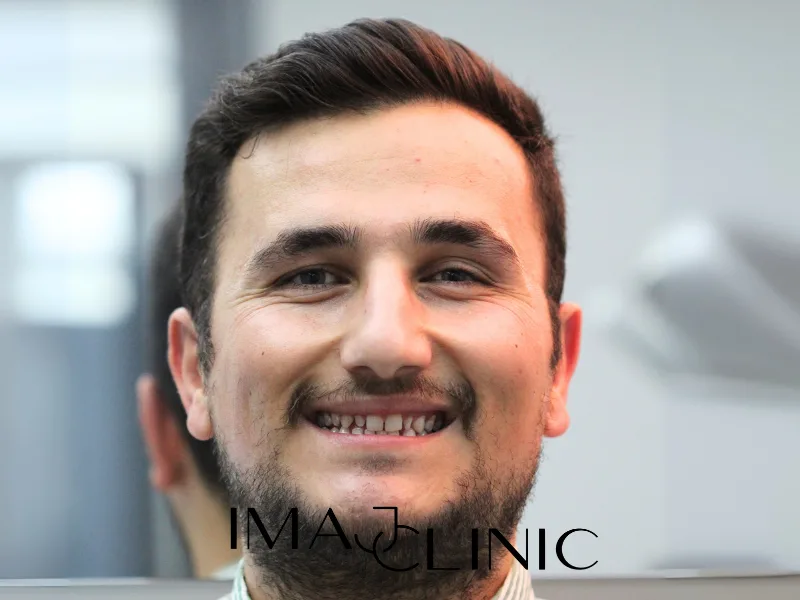 Tedavi öncesi vaka 5