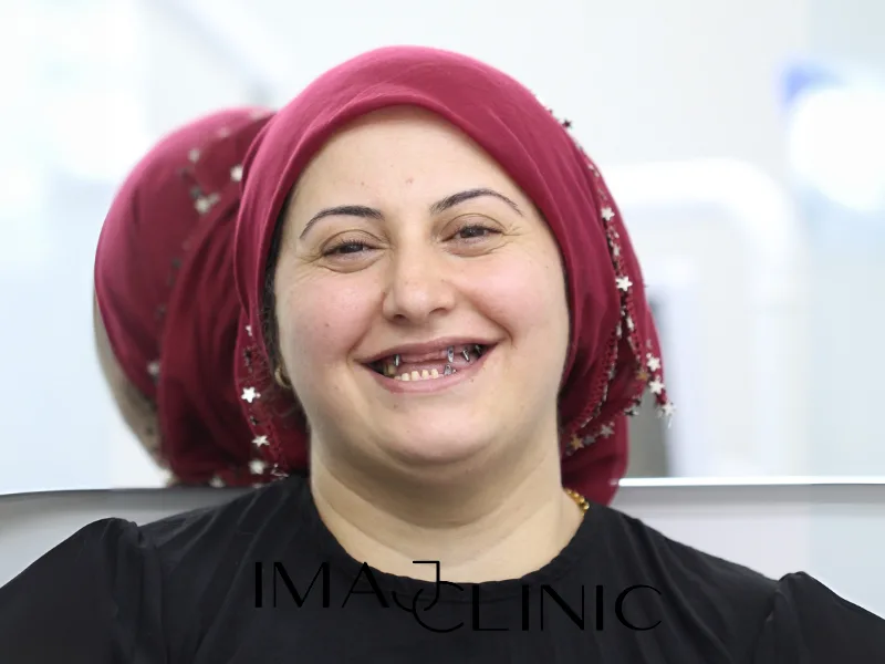 Tedavi öncesi vaka 24