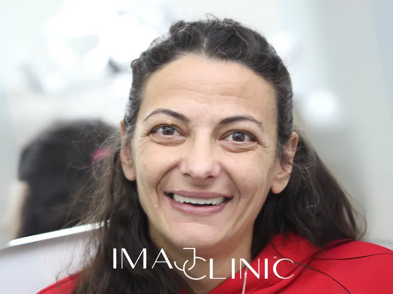 Tedavi sonrası vaka 15