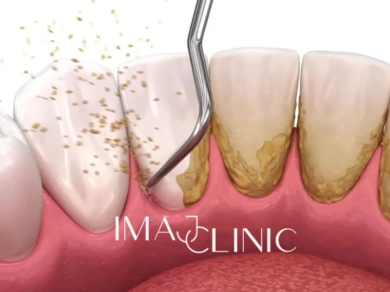 Periodontoloji görseli